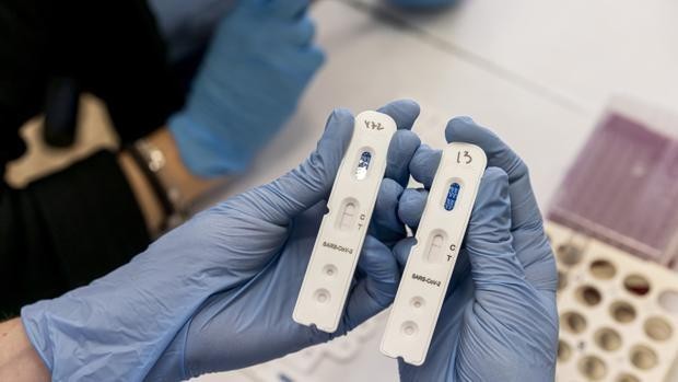 El nuevo test de orina que te permite saber si has pasado el coronavirus y si tienes anticuerpos