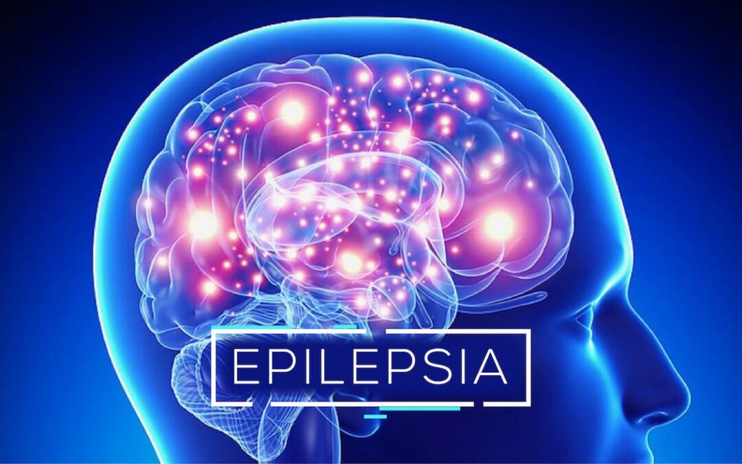 Conciencia de la epilepsia